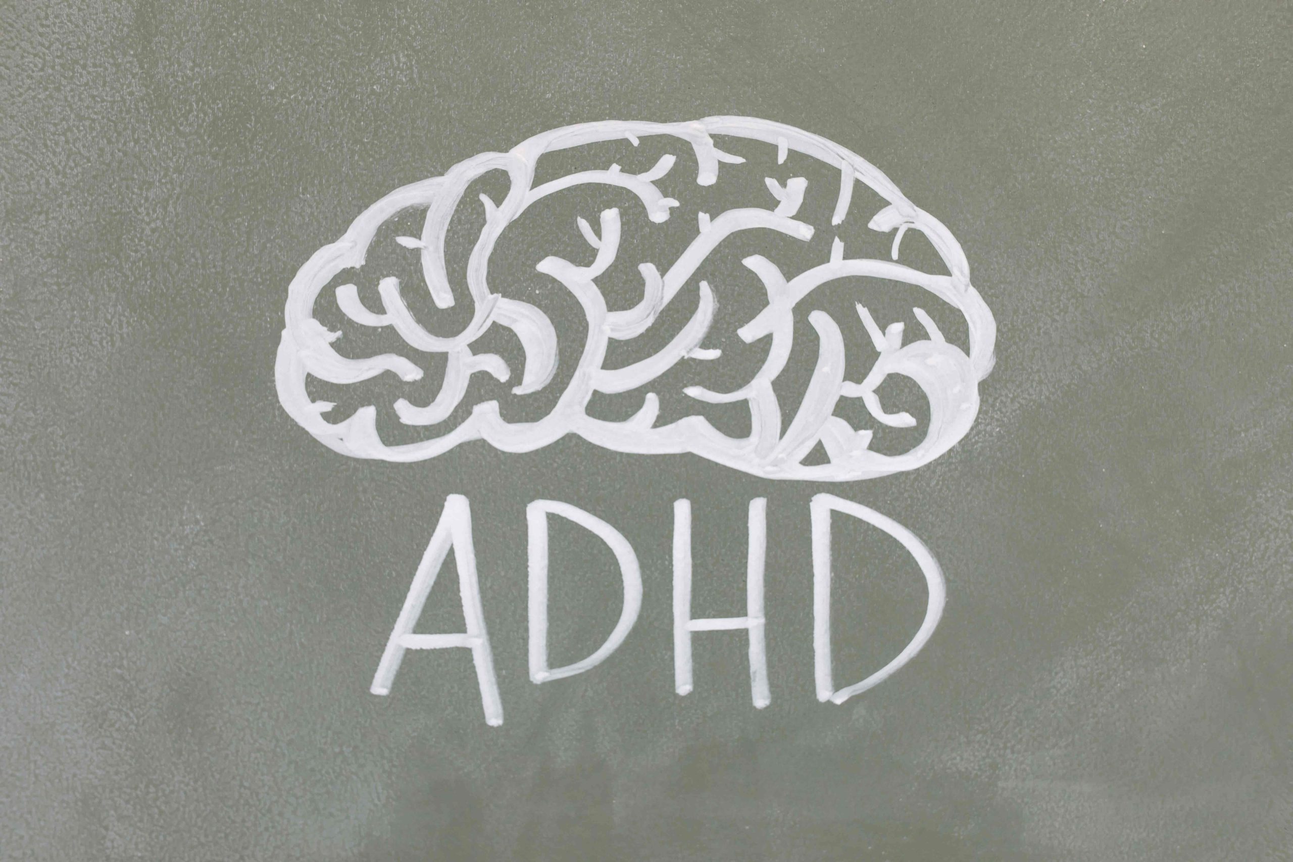 ADHD kod odraslih osoba